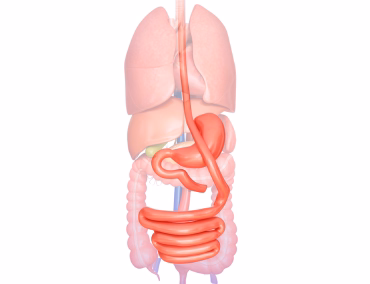 Bypass Gastrique Tunisie